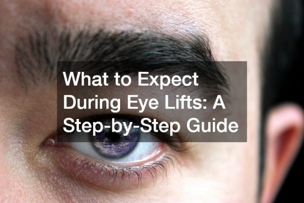 What to Expect During Eye Lifts  A Step-by-Step Guide